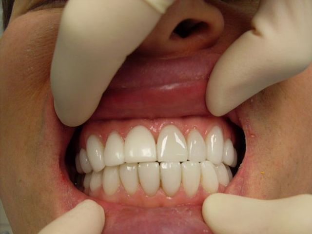 Как лечить глубокий порез? Как вывести краску с одежды в домашних условиях - Мисс Чистота